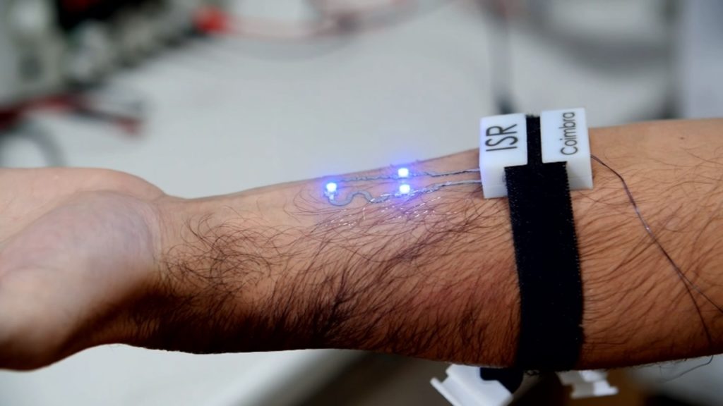 An Electronic tattoo may cure what ails you