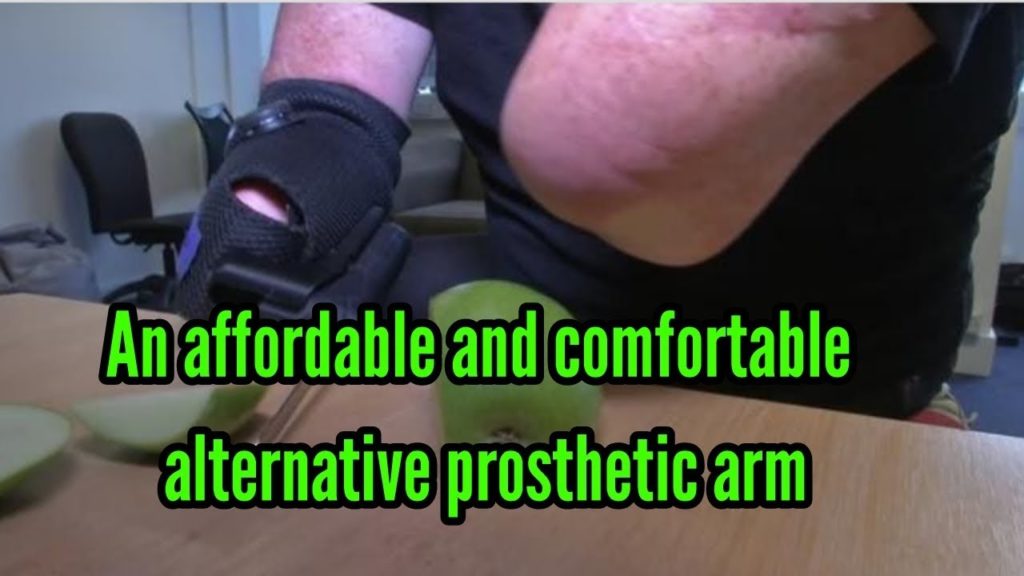 An affordable and comfortable alternative Prosthetic Arm